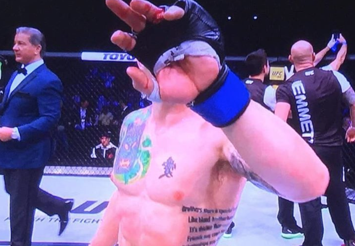 Josh Emmett baugfingur Josh Emmett baugfingur